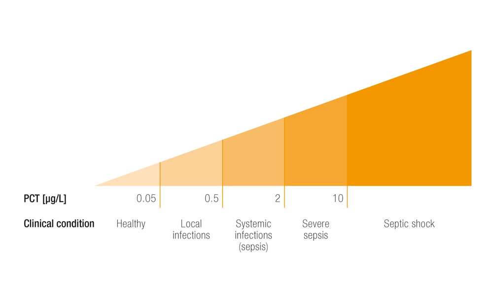 PCT در تشخیص سپسیس
