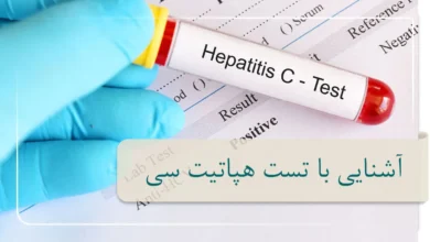 آزمایش هپاتیت C