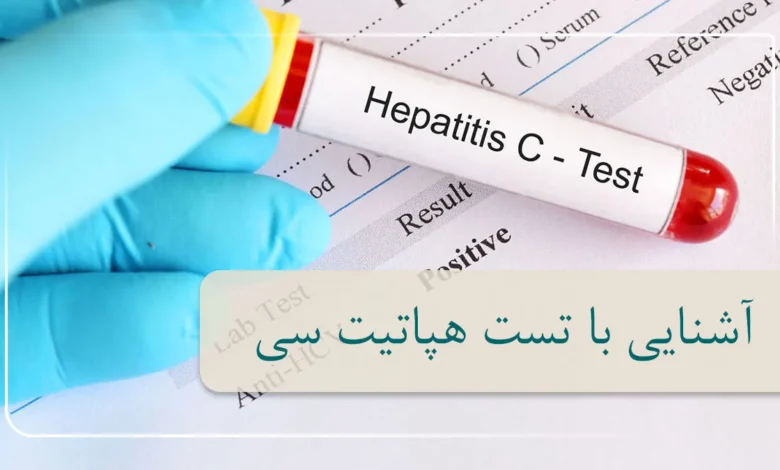 آزمایش هپاتیت C