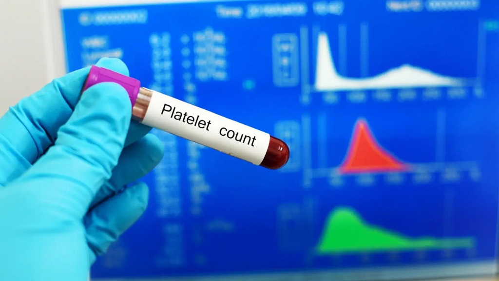 PLT در آزمایش خون