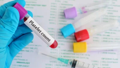 آزمایش پلاکت خون