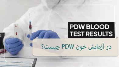 آزمایش pdw