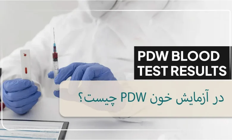 آزمایش pdw