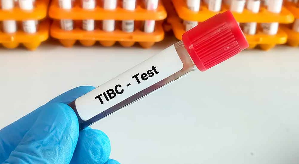 آزمایش TIBC