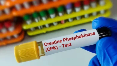 تست CPK چیست