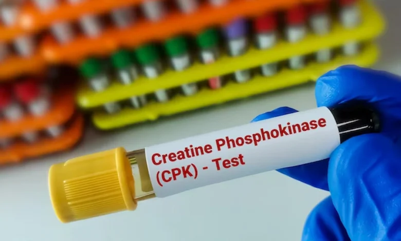 تست CPK چیست