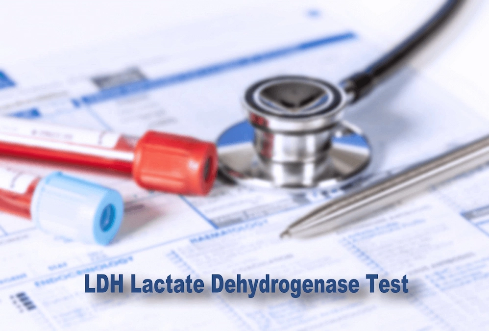 تفسیر آزمایش LDH