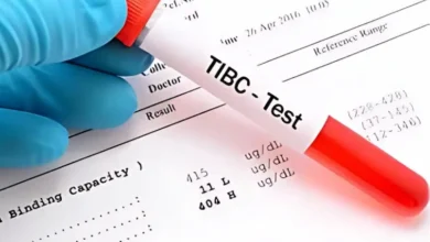 آزمایش TIBC