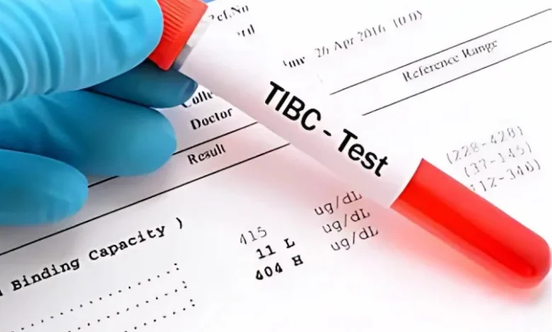آزمایش TIBC