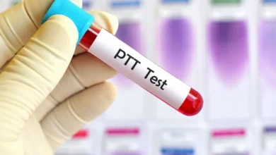 تست PTT