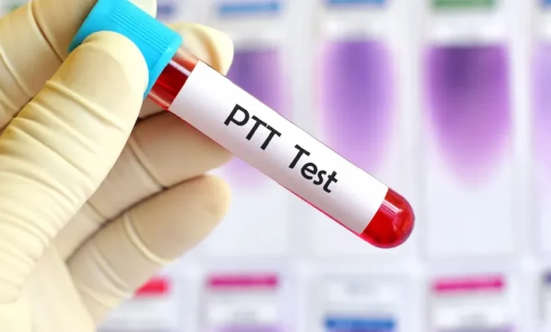 تست PTT
