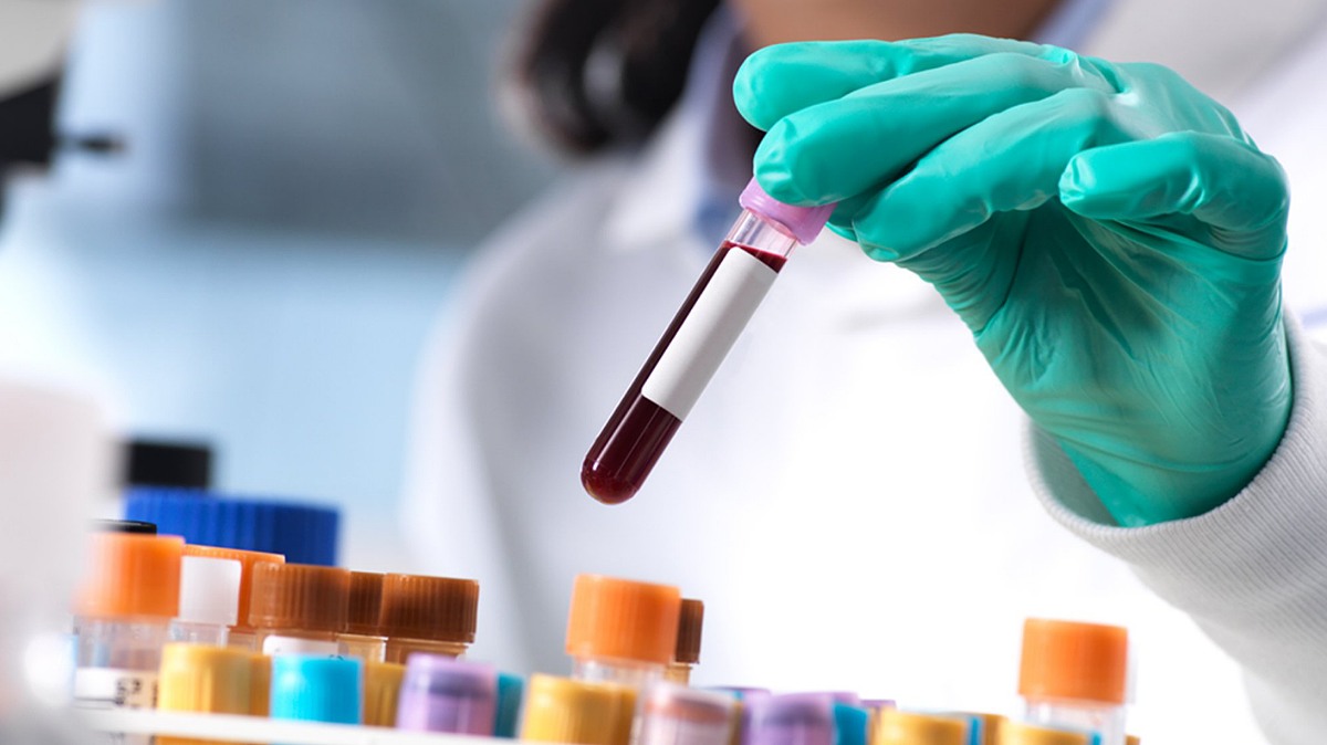 تست سلامت برای ریه