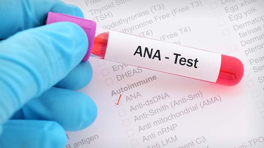 آزمایش خود ایمنی