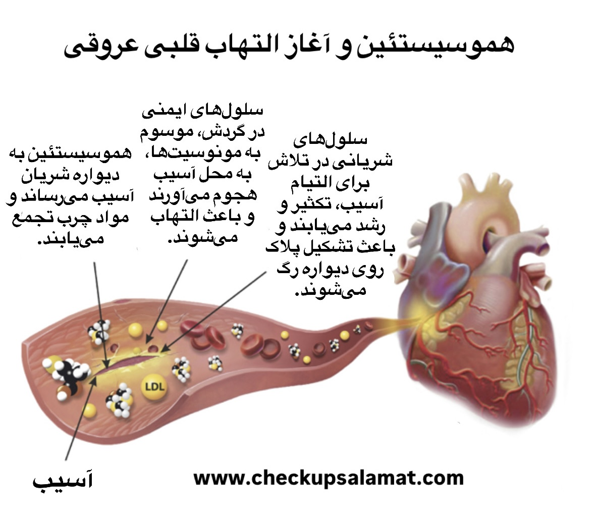 هموسیستئین و بیماری قلبی- عروقی