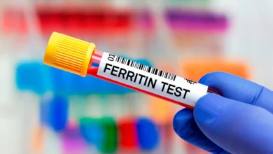 میزان نرمال فریتین در زنان