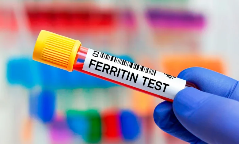 میزان نرمال فریتین در زنان