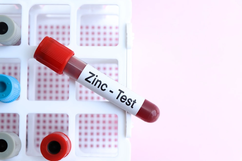 آزمایش زینک در بدن