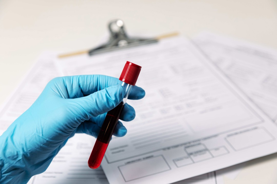 نتایج غیرطبیعی آزمایش خون