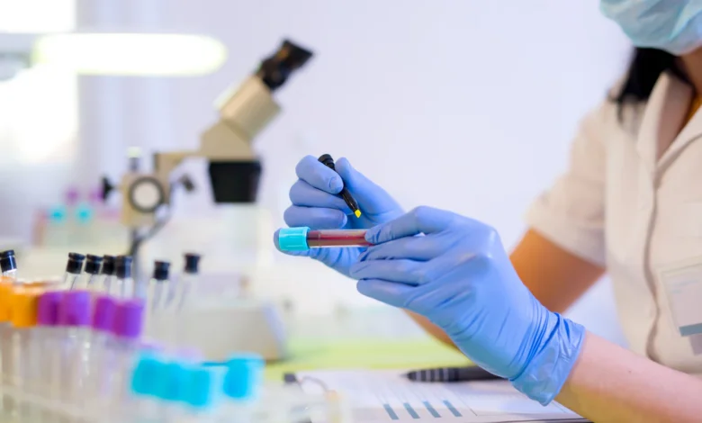 نتایج غیرطبیعی آزمایش خون