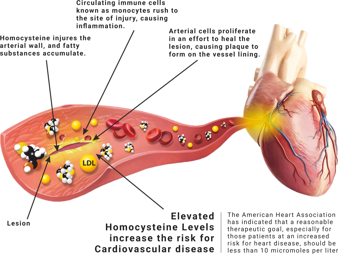 آزمایش هوموسیستئین