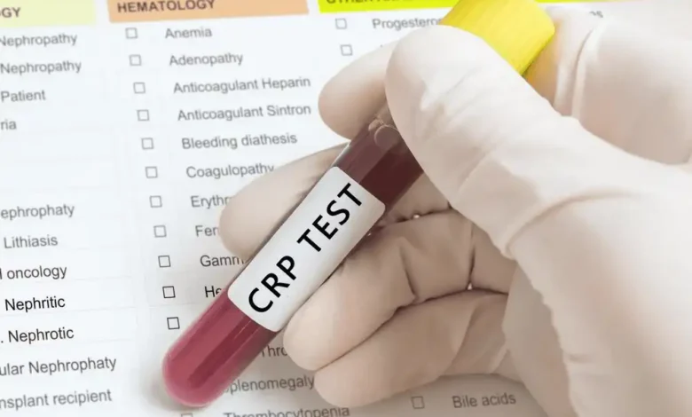 آزمایش CRP و CRP-hs