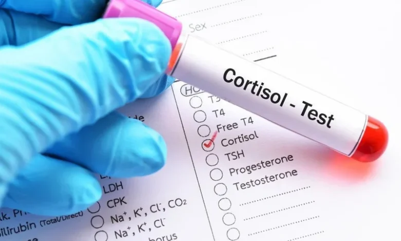 آزمایش کورتیزول