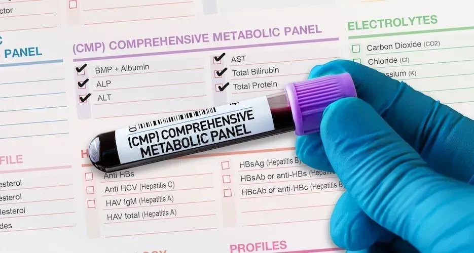 چکاپ متابولیک چیست و چرا بعد از ۳۵ سالگی حیاتی می‌شود؟