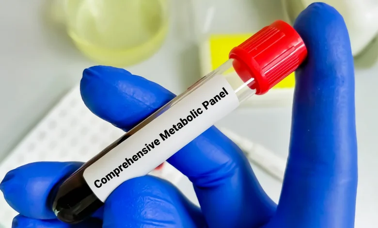 چکاپ متابولیک