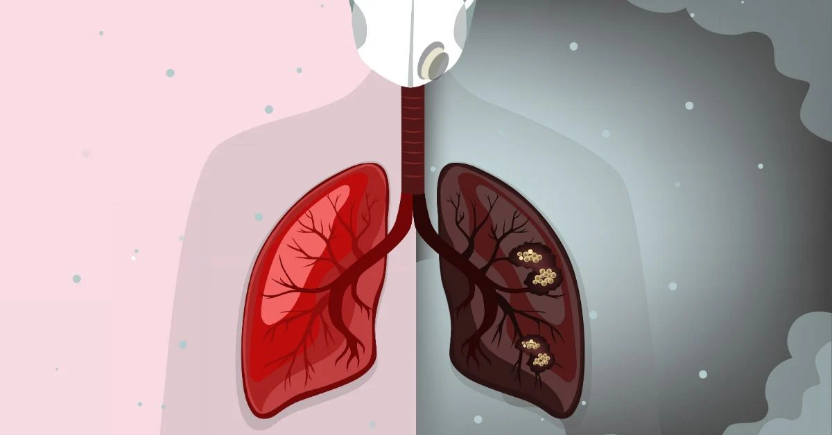 آلودگی هوا و آزمایش خون : نشانه‌های آلودگی هوا در بدن