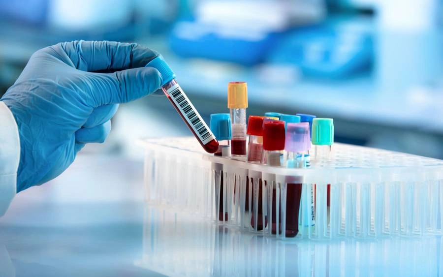 آزمایش بررسی علت فشار خون